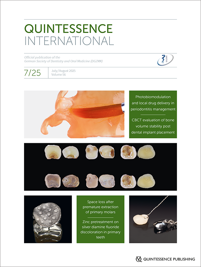 Quintessence International