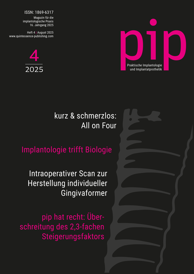 pip - Praktische Implantologie und Implantatprothetik, 04/2025