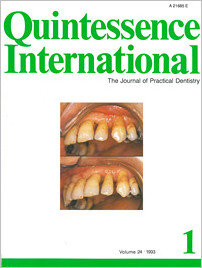 Quintessence International, 10/1993