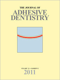 The Journal of Adhesive Dentistry, 2/2011