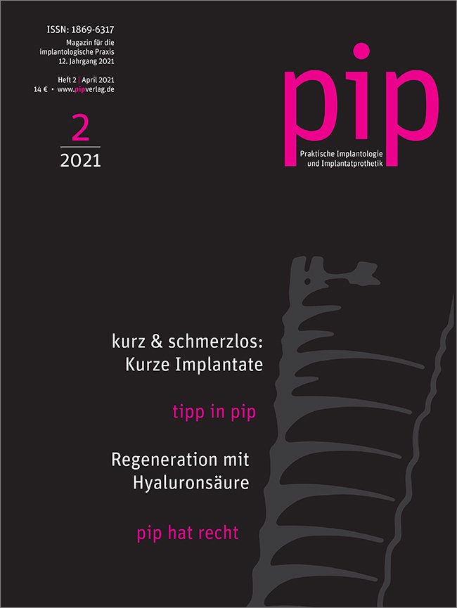 pip - Praktische Implantologie und Implantatprothetik, 2/2021