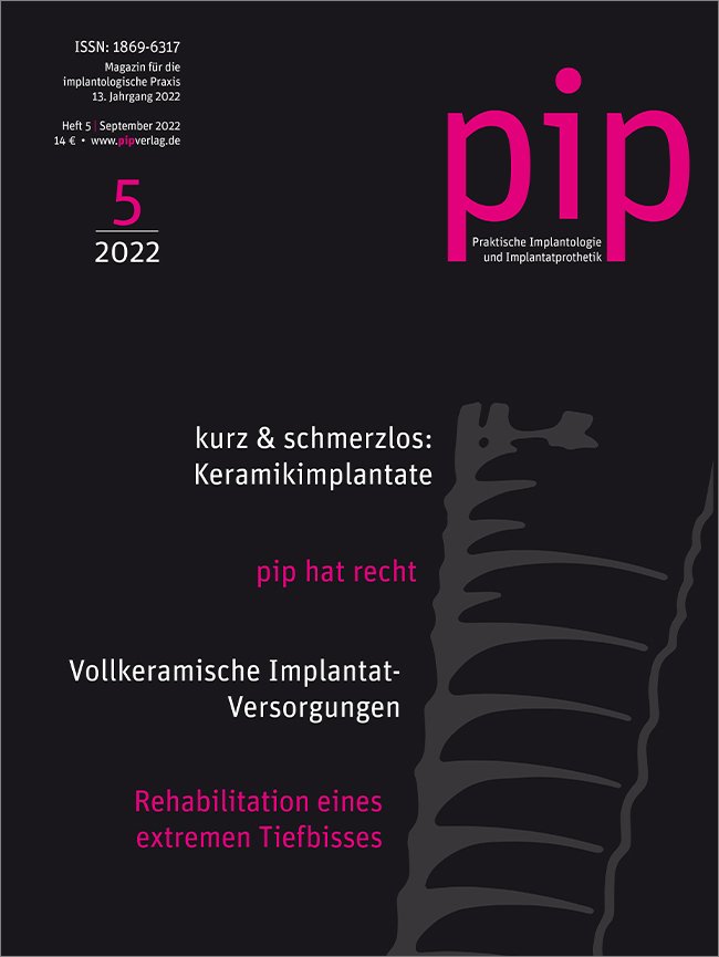 pip - Praktische Implantologie und Implantatprothetik, 5/2022