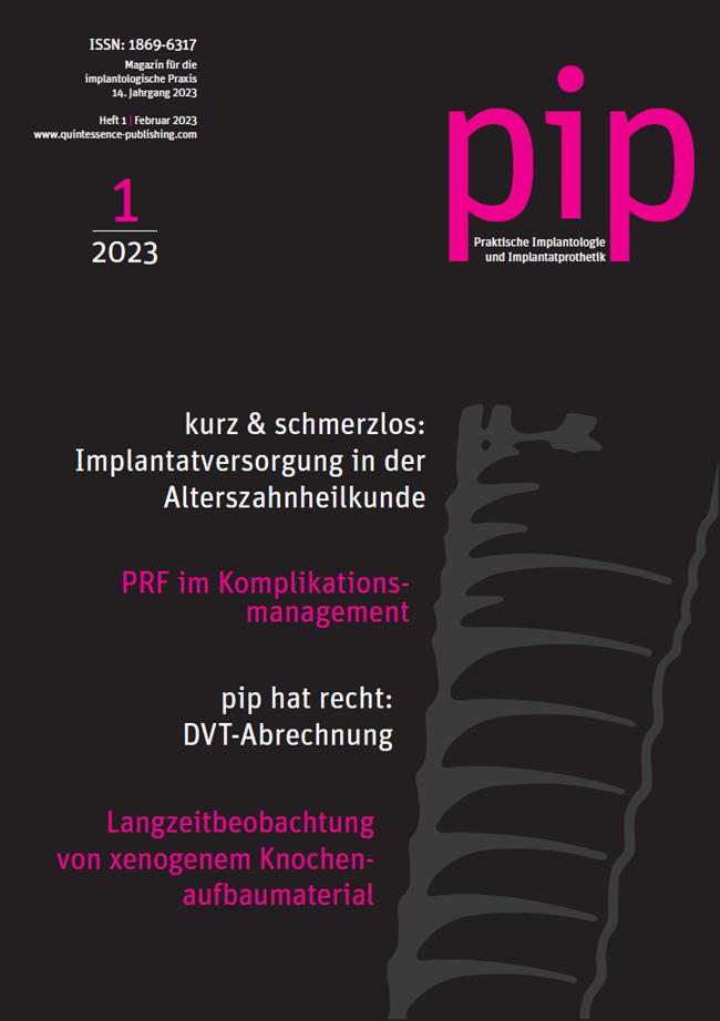pip - Praktische Implantologie und Implantatprothetik, 1/2023