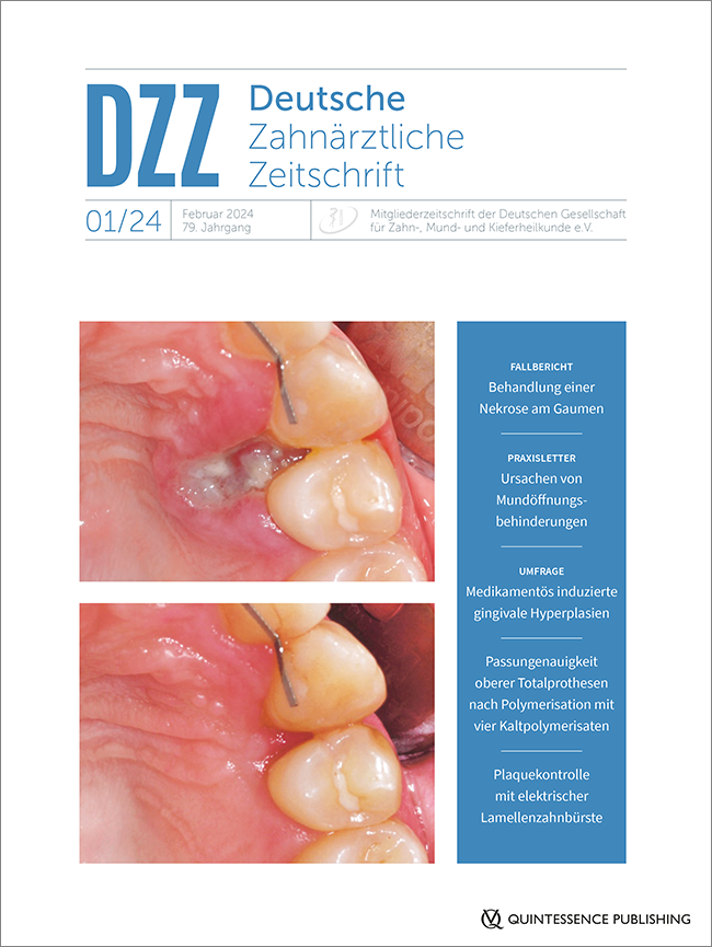 Deutsche Zahnärztliche Zeitschrift, 1/2024