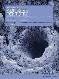 The Journal of Adhesive Dentistry, 2/2020