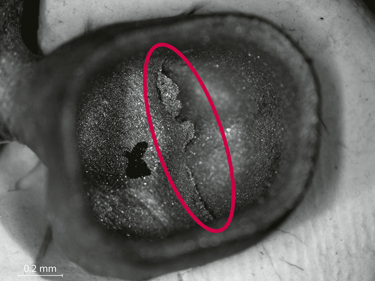 Abb. 10 Lichtmikroskopische Aufnahme einer in Metall umgesetzten Krone, Ansicht von luminal. Zu erkennen ist eine Gussfahne (Markierung). Vergrößerung: 10-fach.