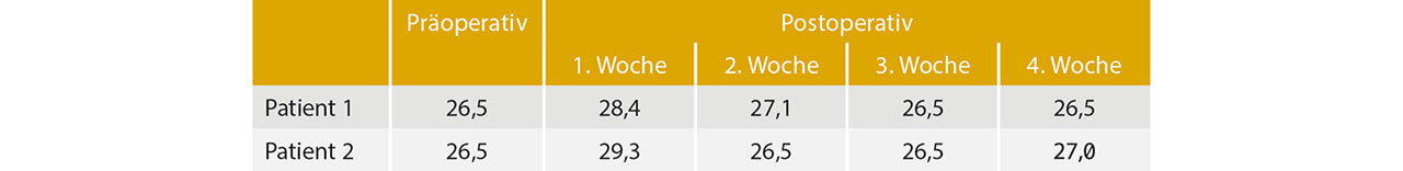 Tab. 5 Postoperative Schwellung in mm (nach Amin und Laskin25).