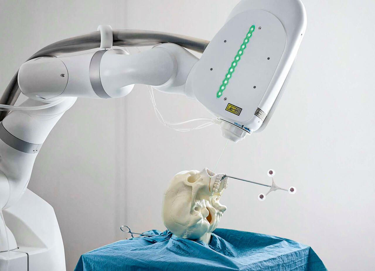 Abb. 8 Der autonom agierende Laser-Operationsroboter CARLO kann die virtuelle Planung von Osteotomien mit hoher Genauigkeit am Patienten umsetzen. (Bildquelle: ­Universitätsspital Basel).
