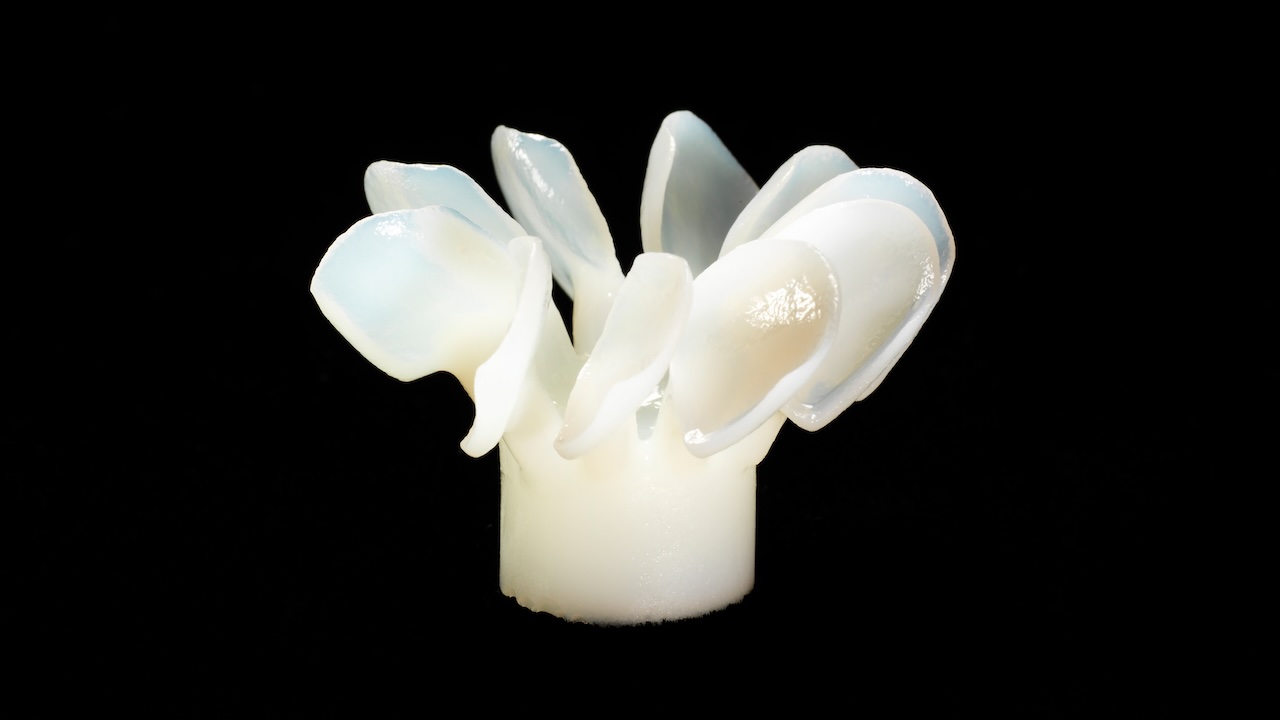Filigrane Veneers aus IPS e.max Press