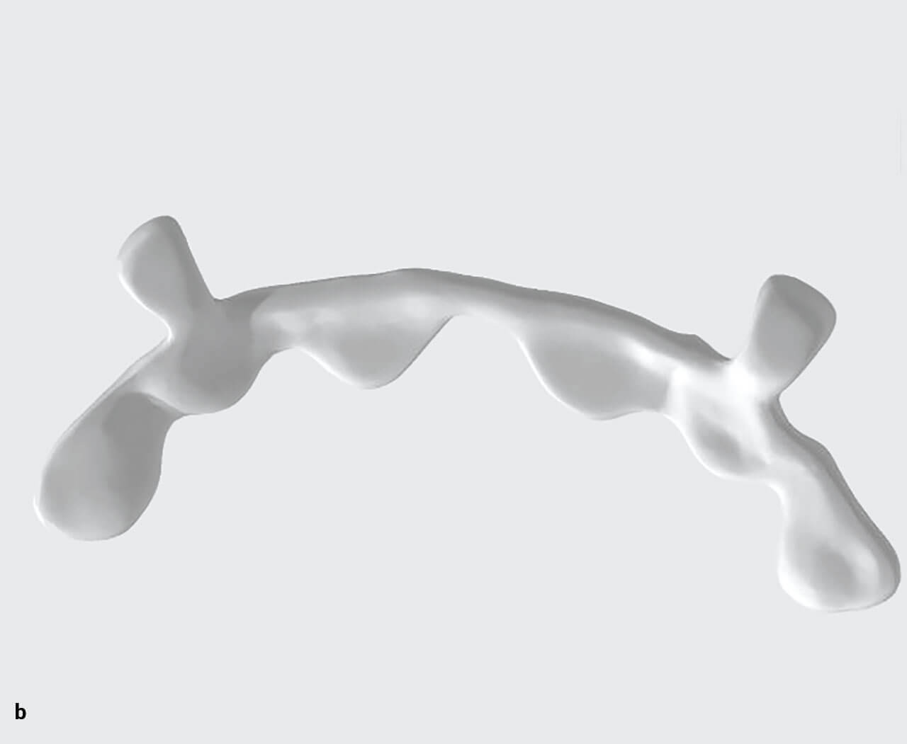 Abb. 9a und b PEEK-Retainer 1 und 2 während der Produktion.