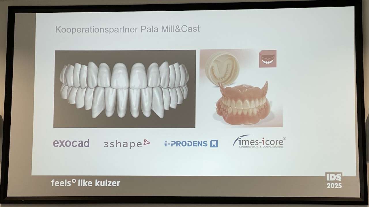 Den hybriden Workflow für die Totalprothetik realisiert Kulzer mit Partner.