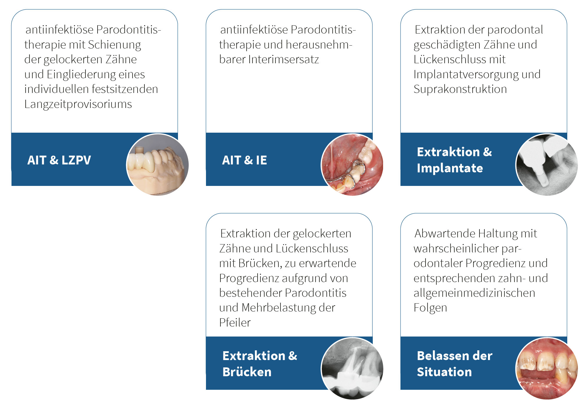 Abb. 4 Darstellung der verschiedenen Therapieoptionen im vorliegenden Fall als Grundlage für die PEF (AIT = antiinfektiöse Parodontitistherapie, IE = Interimsersatz, LZPV = Langzeit­provisorium, PEF = partizipative Entscheidungsfindung).