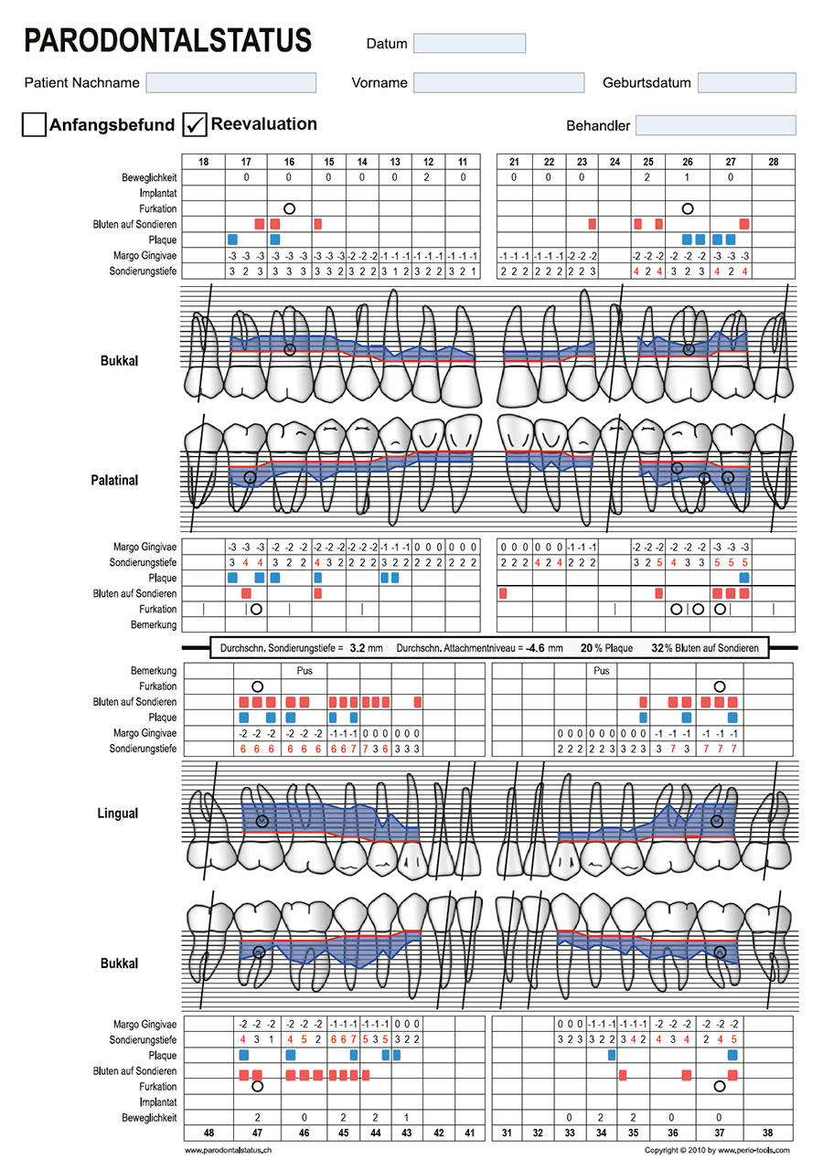 Abb. 5 Parodontalstatus des Patienten 3 Monate nach erfolgter AIT.