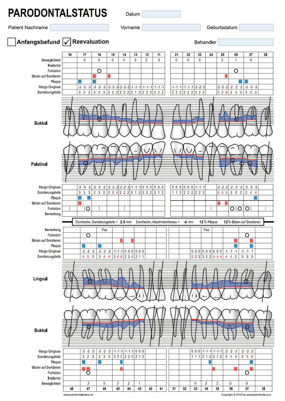 Abb. 6 Parodontalstatus des Patienten 3 Monate nach abgeschlossener parodontalchirurgischer Therapie 6 Monate nach AIT.