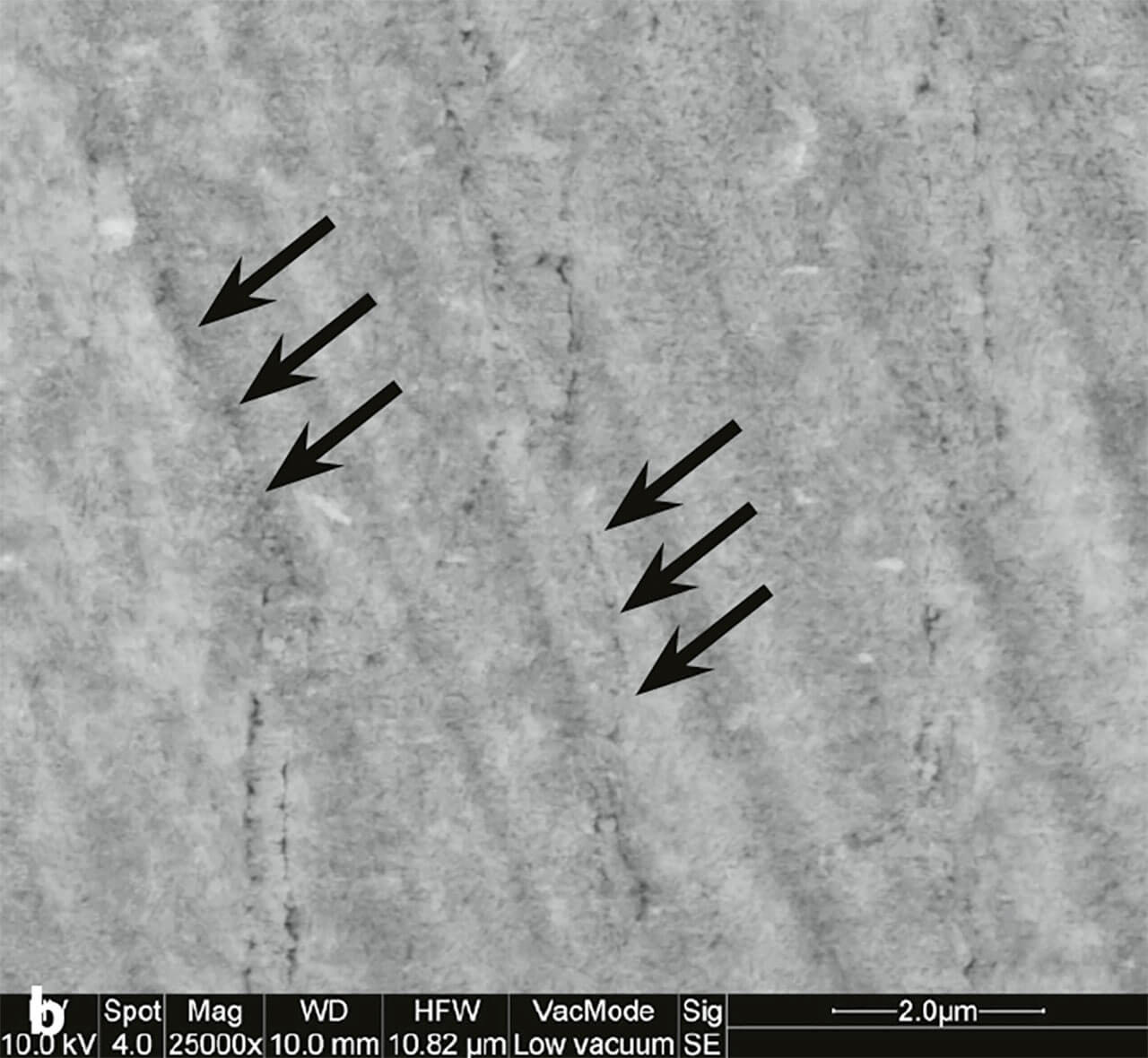 Abb. 1a und b Rasterelektronenmikro­skopische Darstellungen von poliertem Rinderzahnschmelz nach Applikation hochkonzentrierter, saurer Fluoridlösung (10.000 ppm Aminfluorid; a) und ohne Applikation eines Fluoridpräparats (b). Sowohl ohne als auch mit Fluoridappli­kation sind die Prismengrenzen deutlich 
zu erkennen (s. schwarze Pfeile). Nach Fluoridapplikation (a) sind globuläre, Calciumfluorid (CaF2)-artige Präzipitate auf der Oberfläche erkennbar.