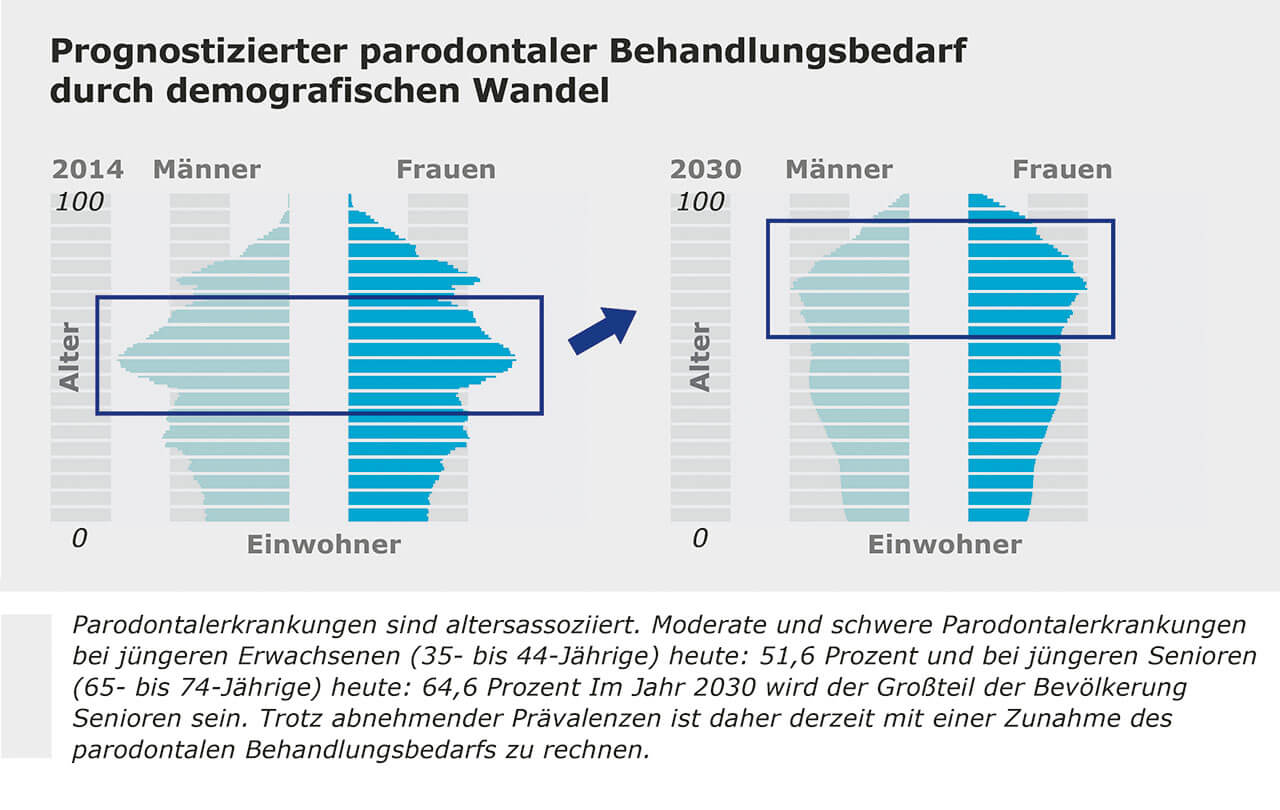 Abb. 1 Prognostizierter parodontaler Behandlungsbedarf durch demografischen Wandel.