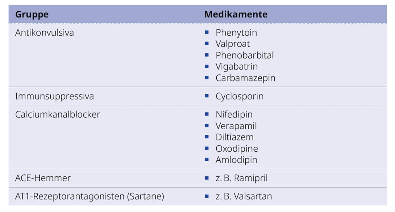 Tab. 2 Übersicht über die bekannten Medikamentengruppen mit bekanntem Risiko für die Bildung von Gingivahyperplasien sowie die zugehörigen Präparate6,1. Die kursiv gedruckten Medikamente wurden erst in letzter Zeit mit Gingivahyperplasien assoziiert8. 
