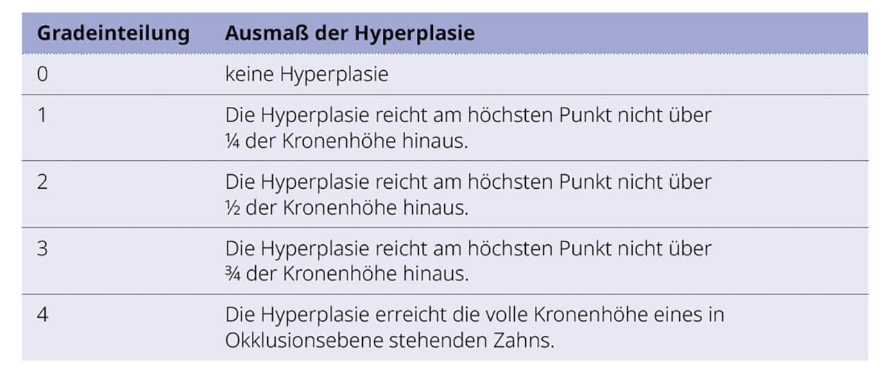 Tab. 3 Gradeinteilung der Gingivahyperplasien nach Wetzel4.
