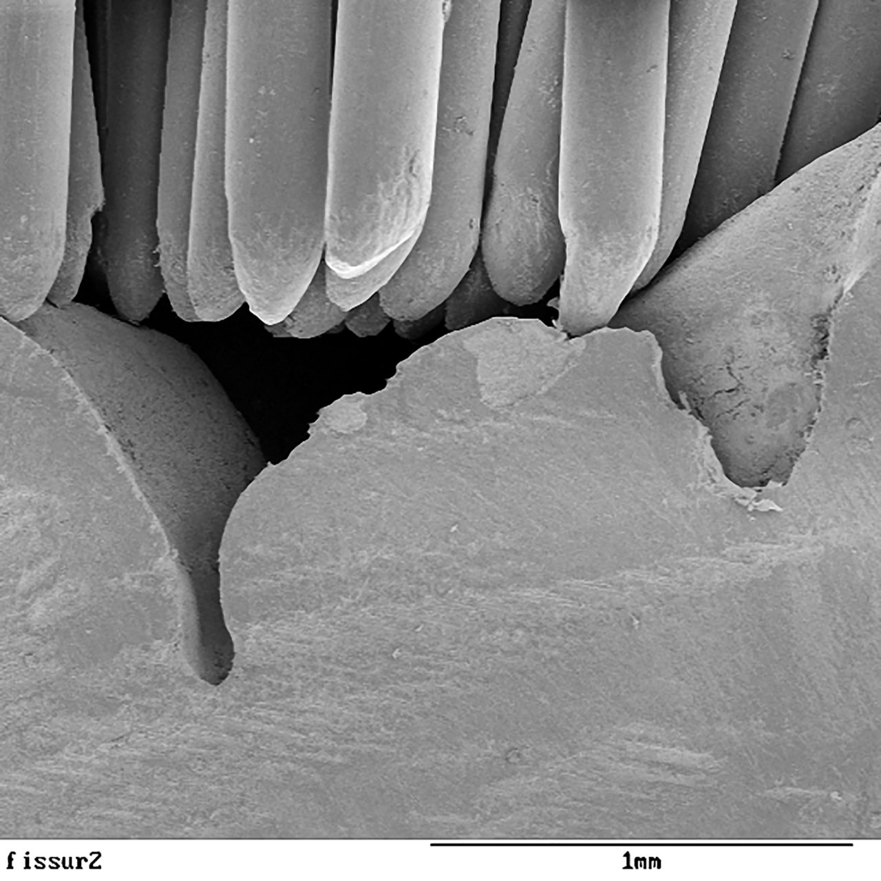 Abb. 5: Rasterelektronenmikroskopische Aufnahme einer Zahnbürste mit ebenem und dichtem Borstenfeld, die fest auf die Kaufläche eines Molaren gepresst wurde – der Fundus der Fissur kann aufgrund des Verkeilungseffekts nicht erreicht werden.