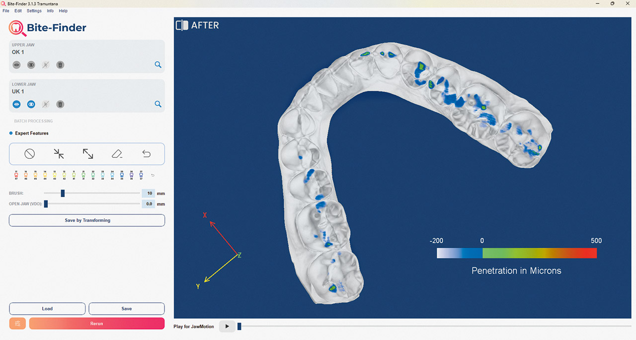 Abb. 3b ... in der Bite-Finder Software.