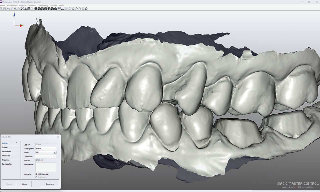 Abb. 1 Import der IOS-Daten in die Magic Master Control-Software (Baumann-Dental).