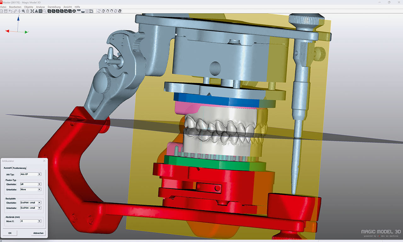 Abb. 2 Übergabe der in der Magic Model3D-Software festgelegten Kieferposition anhand der vorab eingestellten Okklusions- und Medianebene.