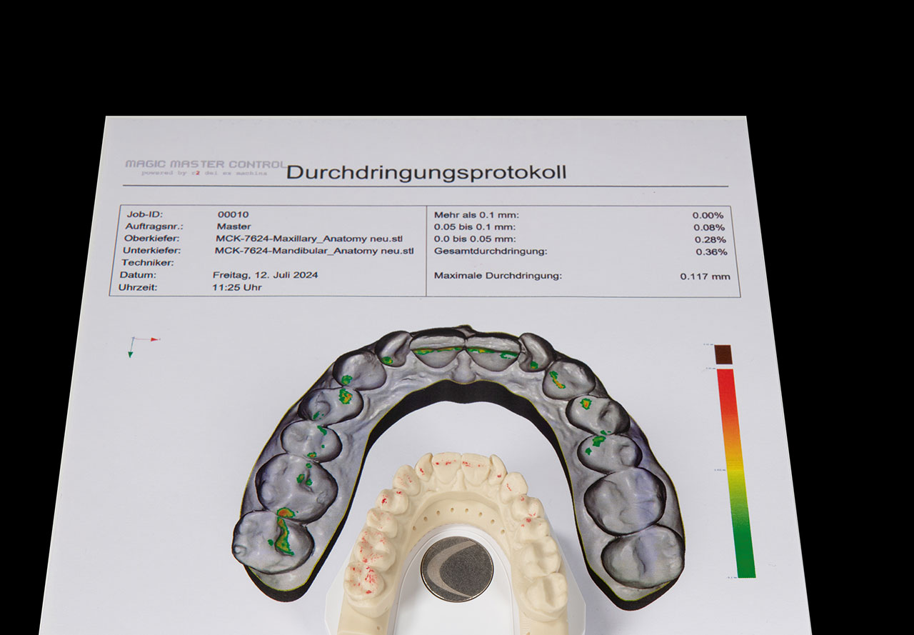 Abb. 6 Okklusionsüberprüfung anhand des Okklusionsplots aus Magic Master Control. Die Kieferrelation konnte von digital zu analog durch gipsfreies Einartikulieren überführt werden.