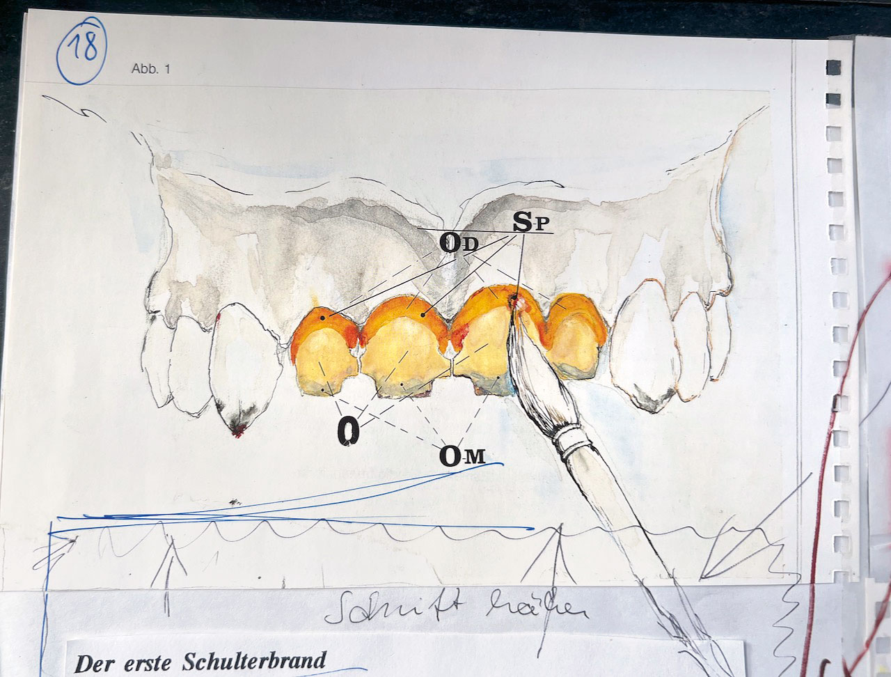 Abb. 11  Die Schultermassen von Creation Willi Geller waren fluoreszierend.