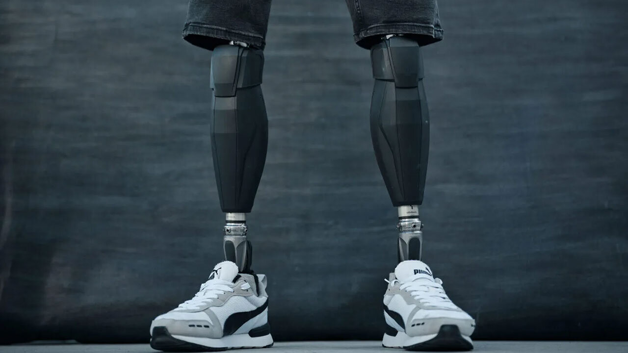 Zwei schwarze Unterschenkelprothesen in weißen Turnschuhen stehen aufrecht, bis zum Knie zu sehen.
