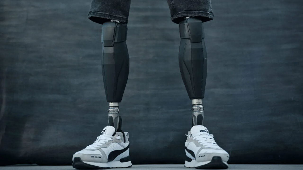 Zwei schwarze Unterschenkelprothesen in weißen Turnschuhen stehen aufrecht, bis zum Knie zu sehen.