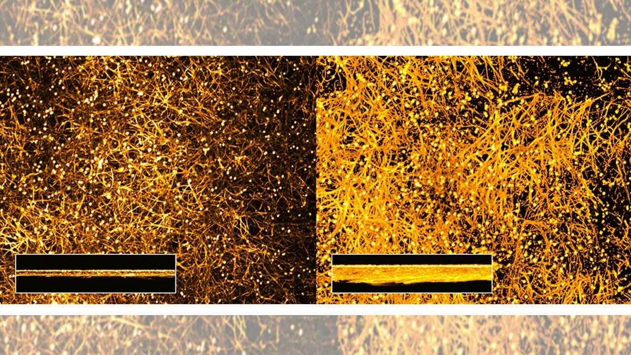 Ein Vergleich zweier Fotos von Candida albicans zeigt, dass in Gegenwart von menschlichem Albumin (rechts) ein dichterer Biofilm gebildet wird als in dessen Abwesenheit (links). Auf den Fotos wurden die Hefezellen in einem goldenen Farbton eingefärbt.