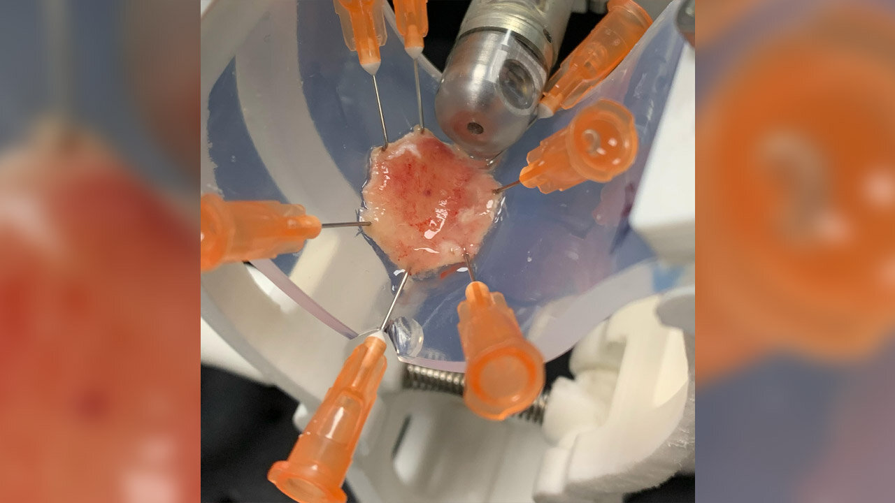 Ein mit orangenen Präpariernadeln gehaltenes präpariertes Stück menschlicher Schleimhaut in einer Versuchsapparatur mit einem Scangerät am oberen Bildrand.