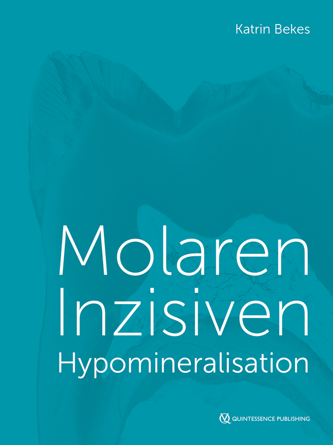 Bekes: Molaren-Inzisiven-Hypomineralisation
