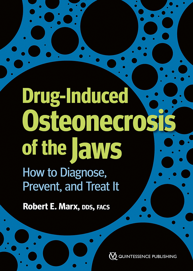 Marx: Drug-Induced Osteonecrosis of the Jaws