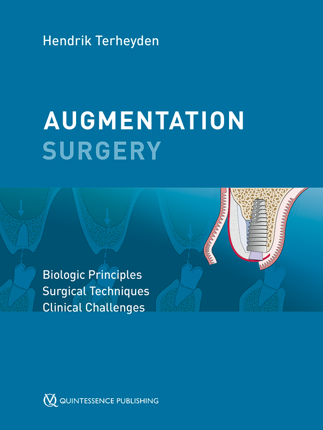 Terheyden: Augmentation Surgery