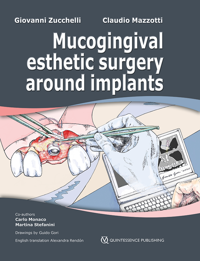 Zucchelli: Mucogingival Esthetic Surgery around Implants