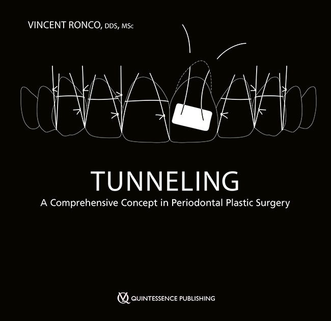 Ronco: Tunneling