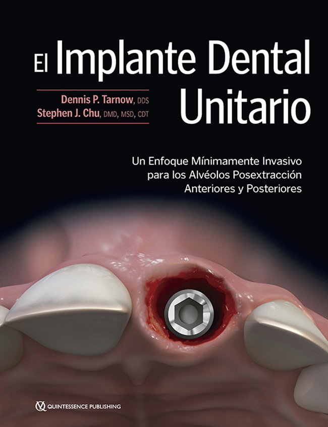 Tarnow: El Implante Dental Unitario   