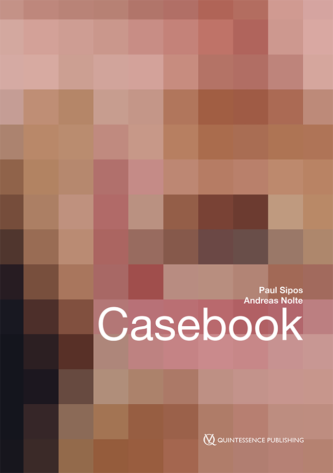 Sipos: Casebook