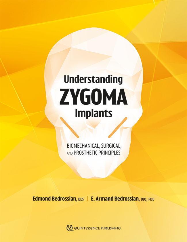 Bedrossian: Understanding Zygoma Implants