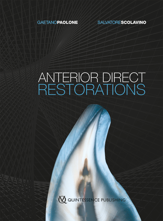 Paolone: Anterior Direct Restorations