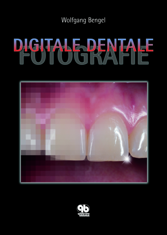 Bengel: Digitale Dentale Fotografie