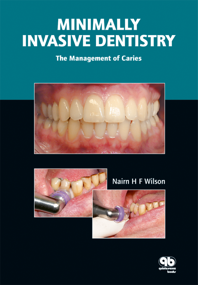 Wilson: Minimally Invasive Dentistry
