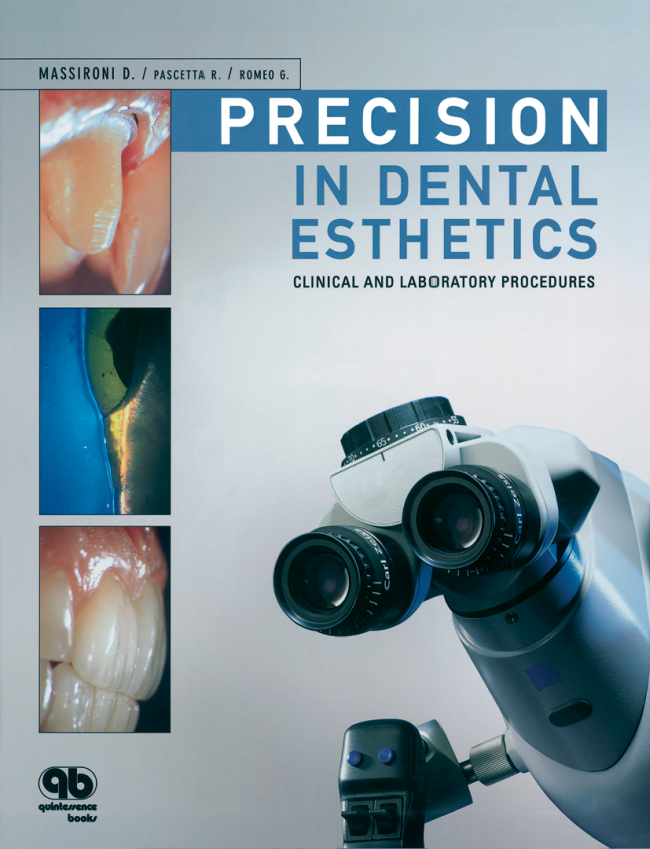 Massironi: Precision in Dental Esthetics