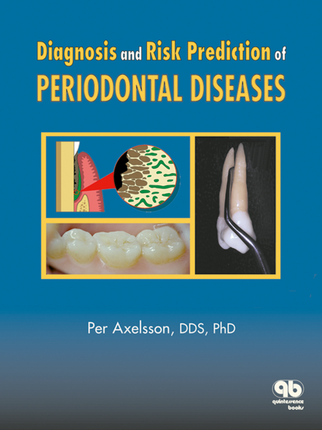Axelsson: Diagnosis and Risk Prediction of Periodontal Diseases
