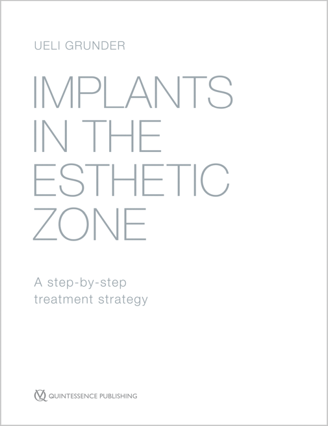 Grunder: Implants in the Esthetic Zone