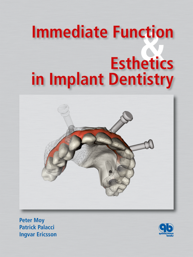 Moy: Immediate Function & Esthetics in Implant Dentistry