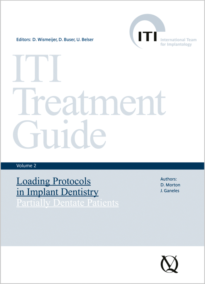 Wismeijer: Loading Protocols in Implant Dentistry