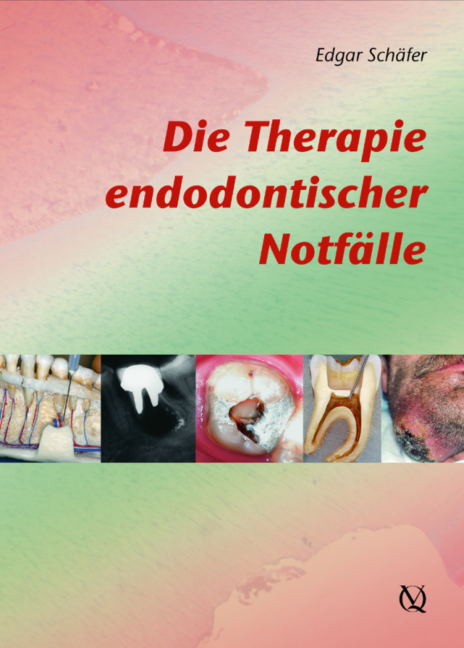 Schäfer: Die Therapie endodontischer Notfälle