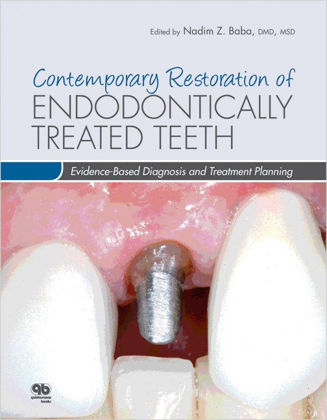 Baba: Contemporary Restoration of Endodontically Treated Teeth